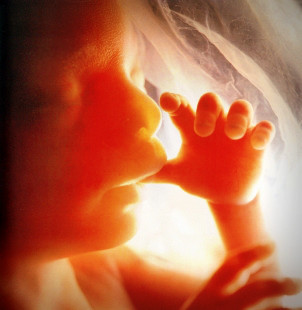Schutz des ungeborenen Lebens